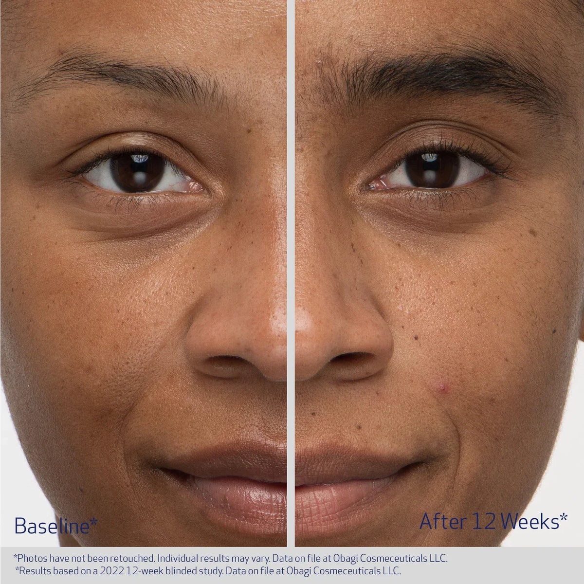 Obagi Nu-Cil Eyebrow Boosting Serum image 6