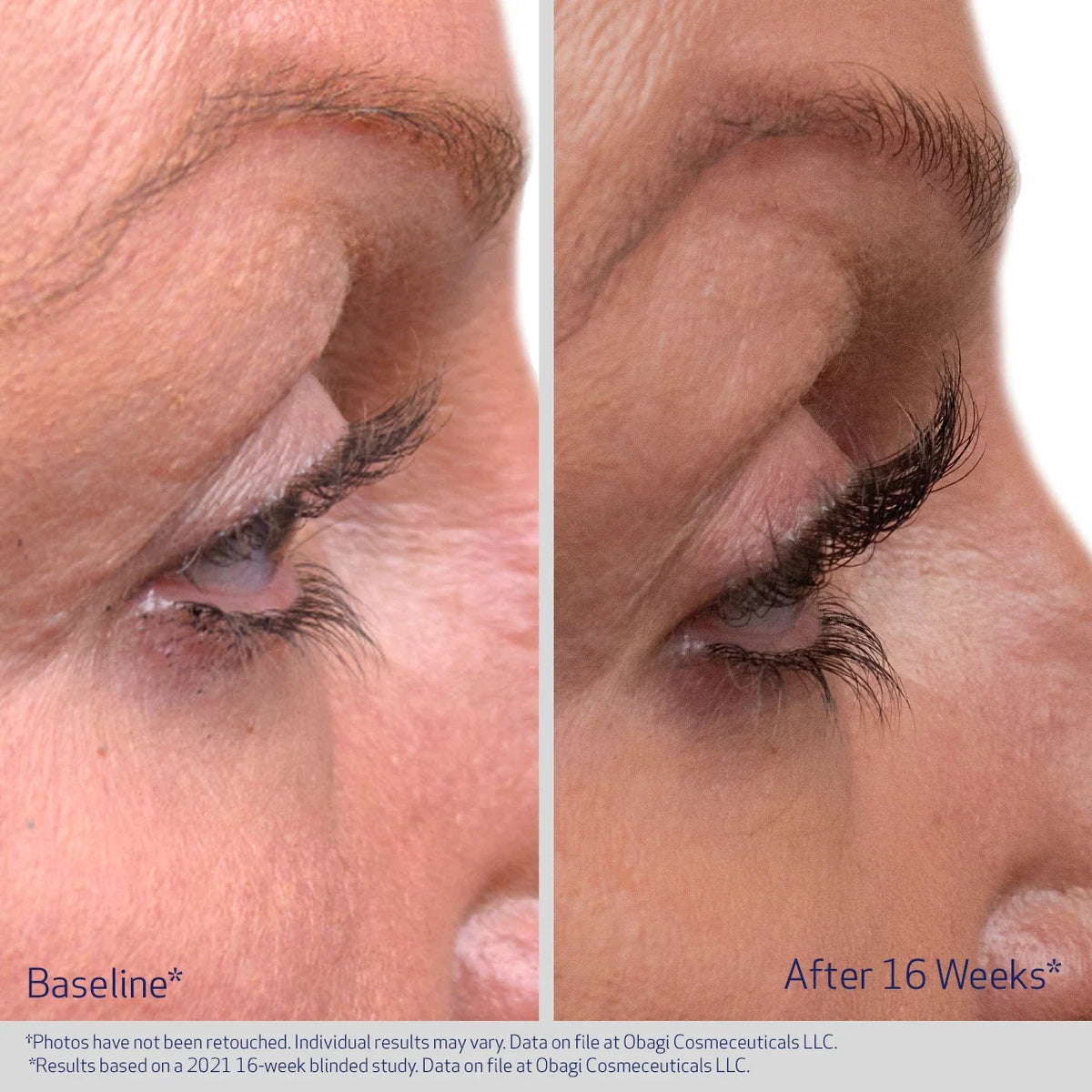 Obagi Nu-Cil Eyelash Enhancing Serum image 5