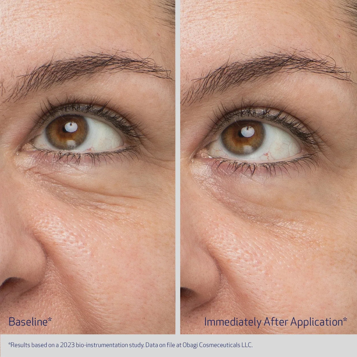 Obagi Daily Hydro-Drops Rejuvenating Eye Gel Cream image 3