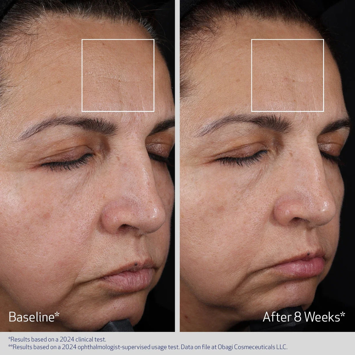Obagi Elastiderm Advanced Filler Concentrate image 5