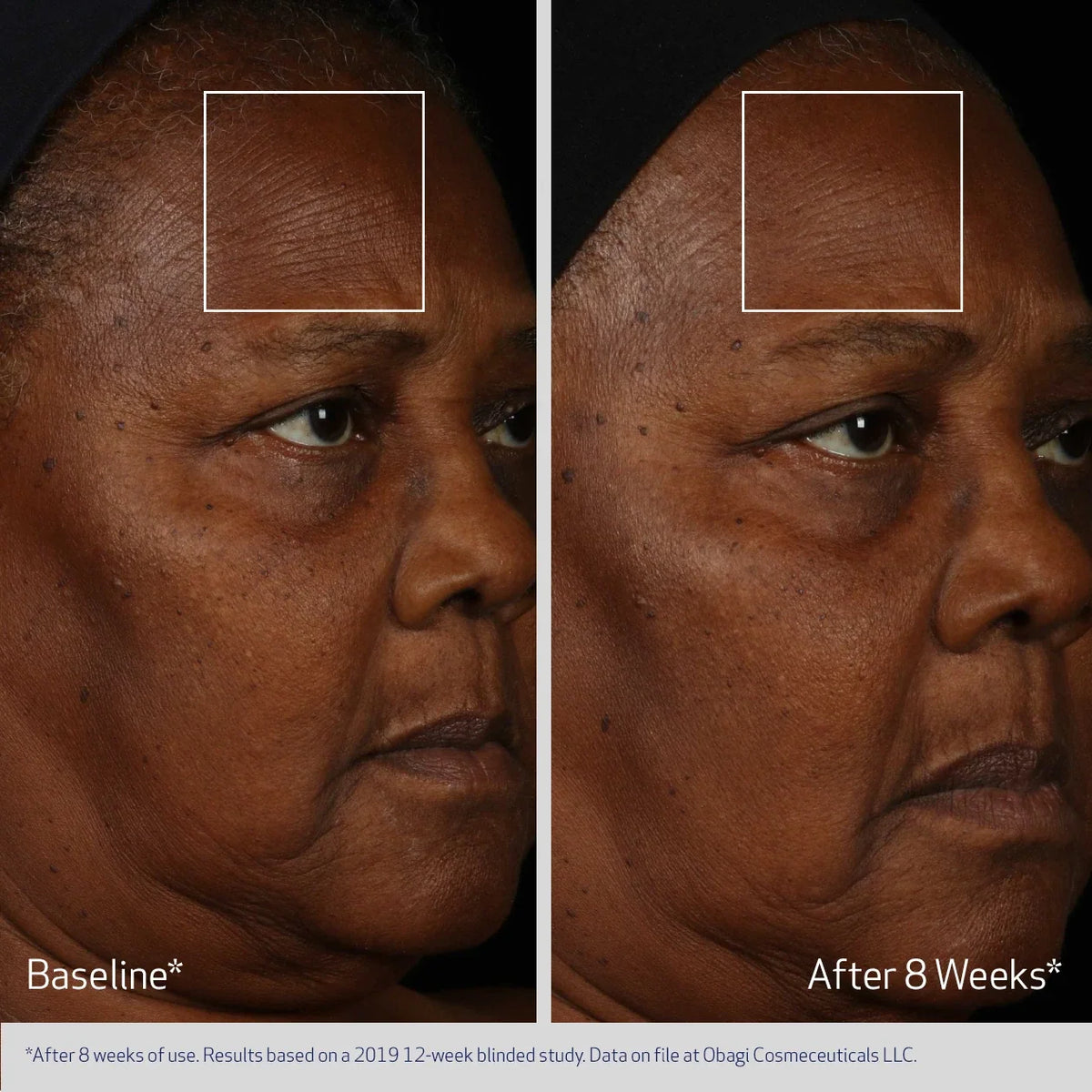 Obagi Elastiderm Facial Serum image 4