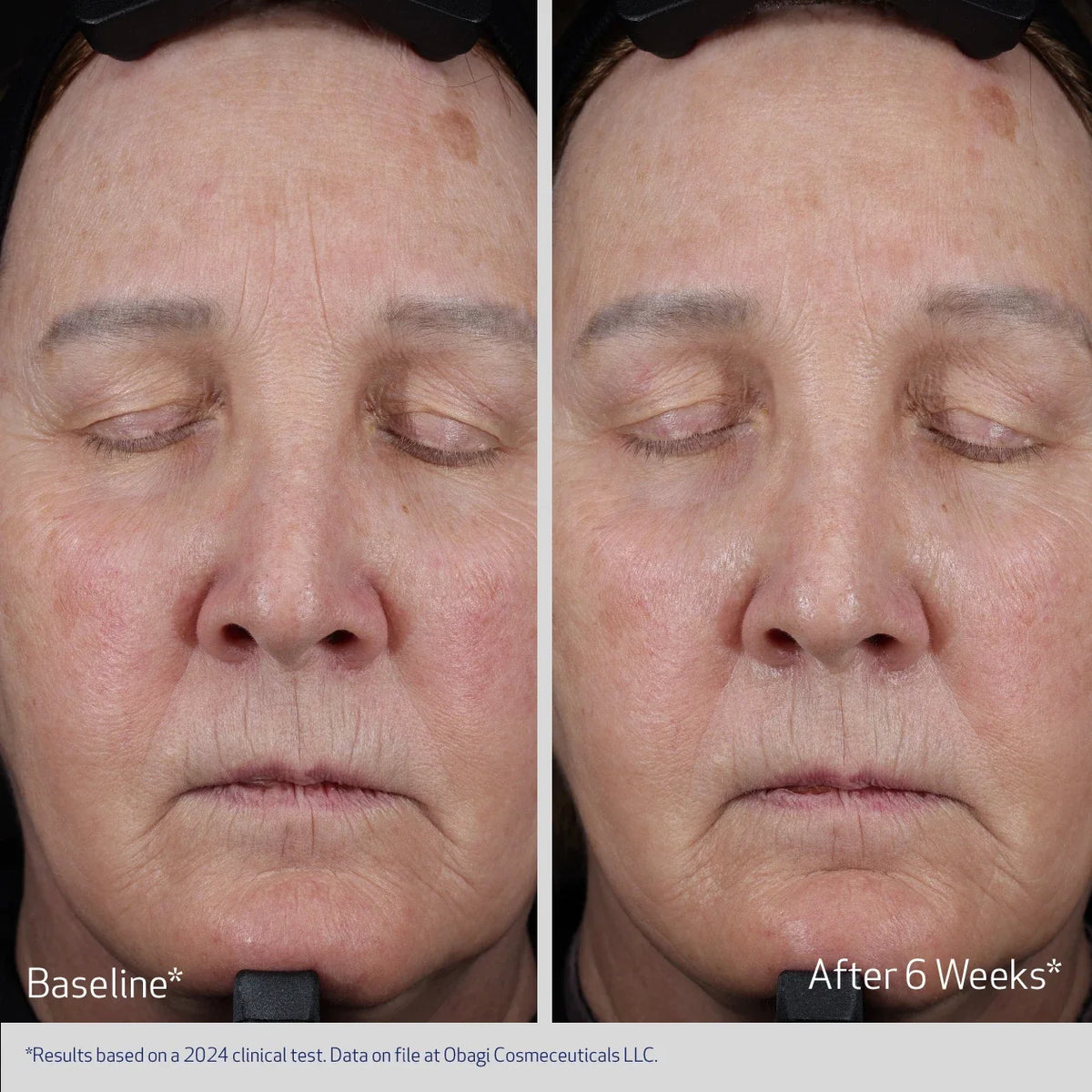 Obagi Elastiderm Lift Up & Sculpt Facial Moisturiser image 2