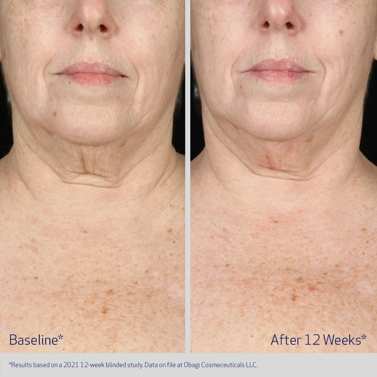Obagi Elastiderm Neck and Décolleté Concentrate image 5
