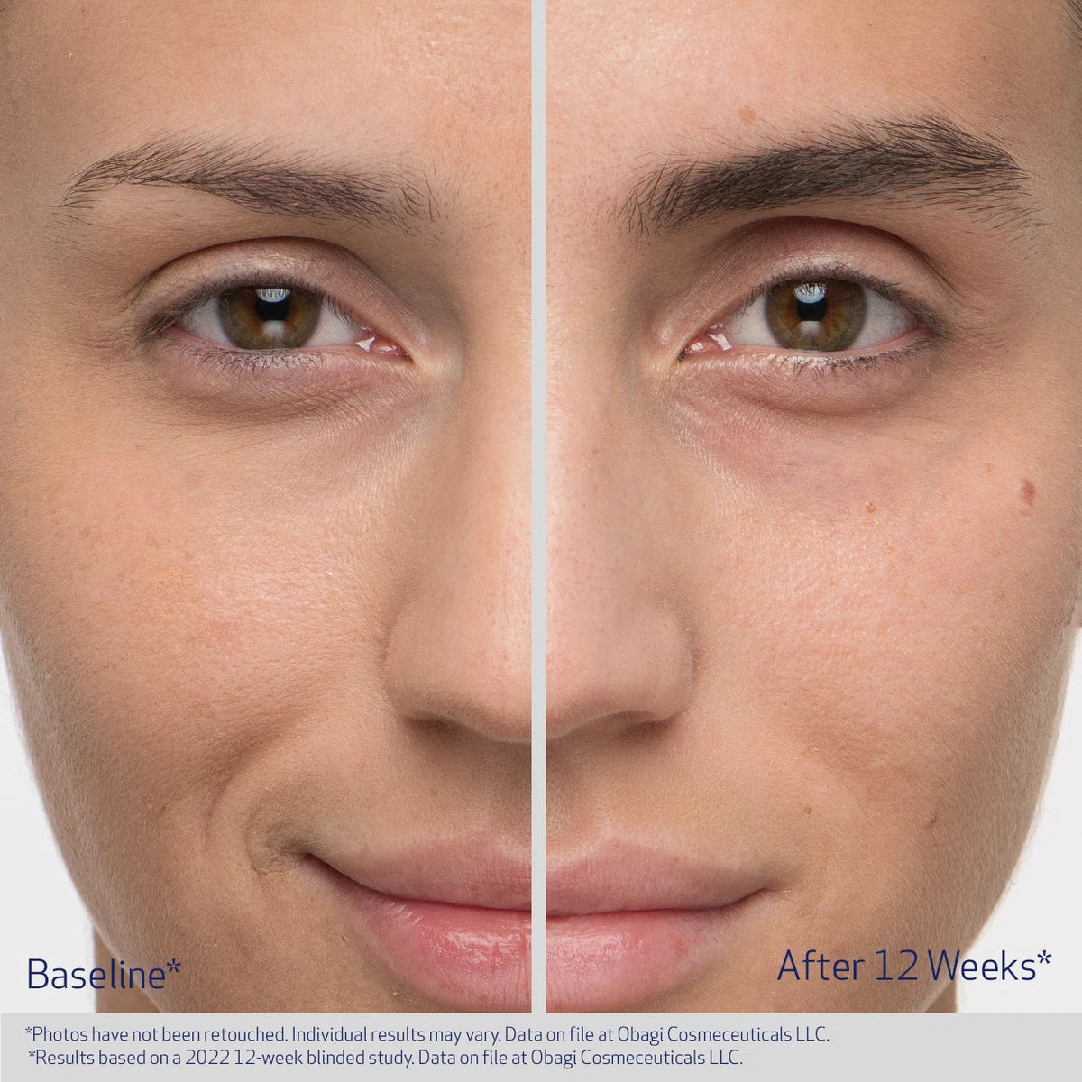 Obagi Nu-Cil Eyebrow Boosting Serum image 7