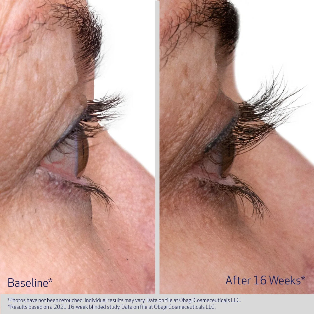 Obagi Nu-Cil Eyelash Enhancing Serum image 6
