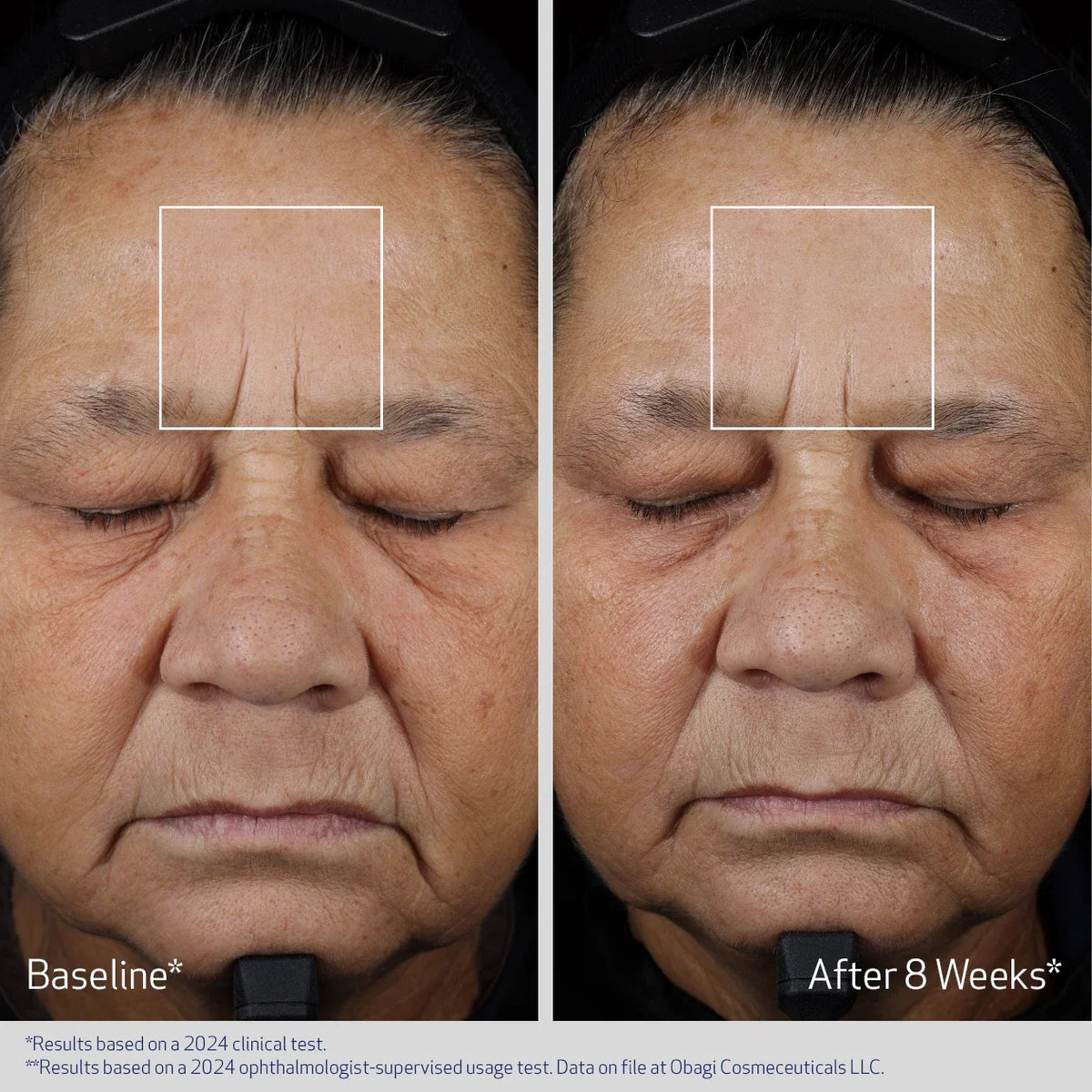 Obagi Elastiderm Advanced Filler Concentrate image 6
