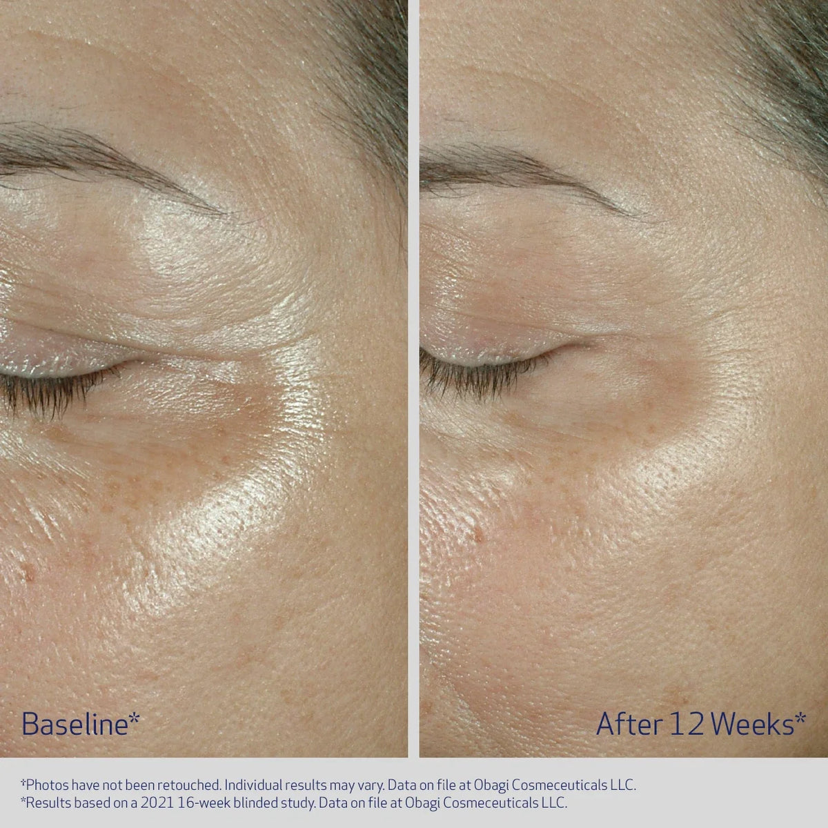 Obagi Elastiderm Eye Cream image 2