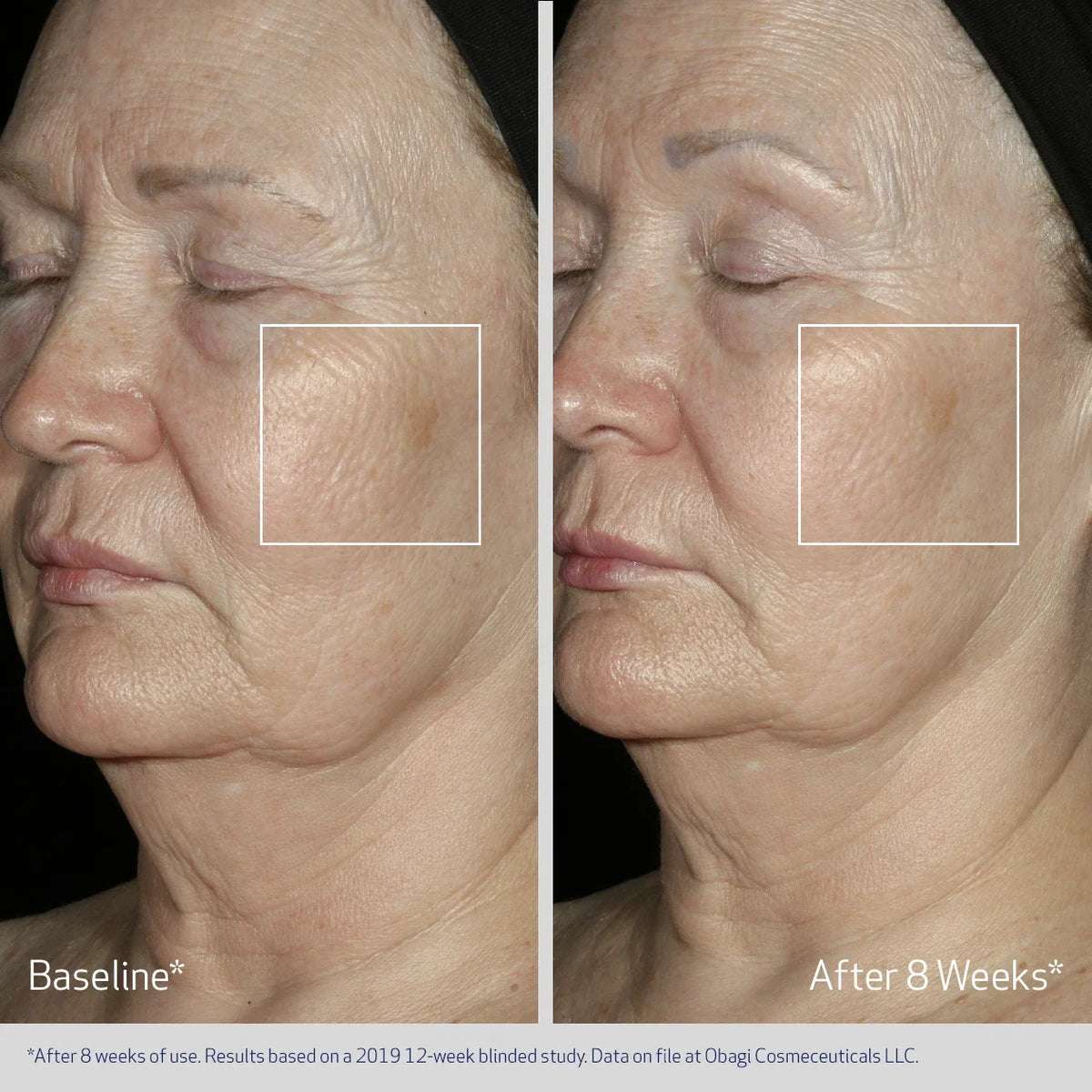 Obagi Elastiderm Facial Serum image 5