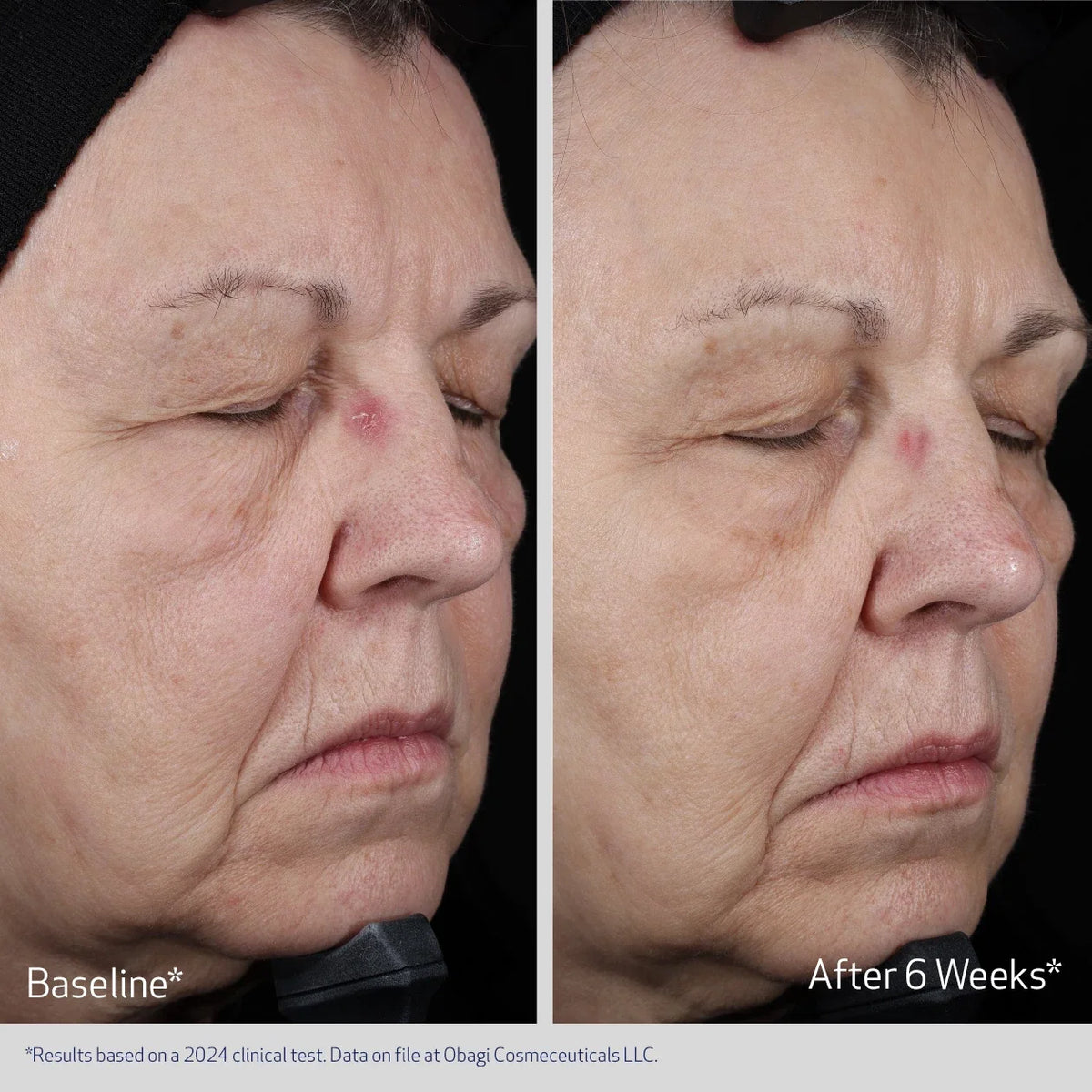 Obagi Elastiderm Lift Up & Sculpt Facial Moisturiser image 6