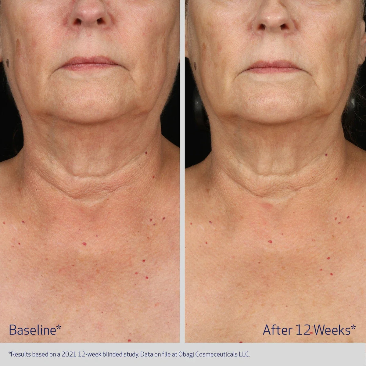 Obagi Elastiderm Neck and Décolleté Concentrate image 6