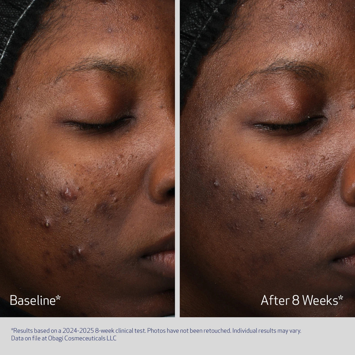 Obagi Retinol + PHA Refining Night Cream image 5