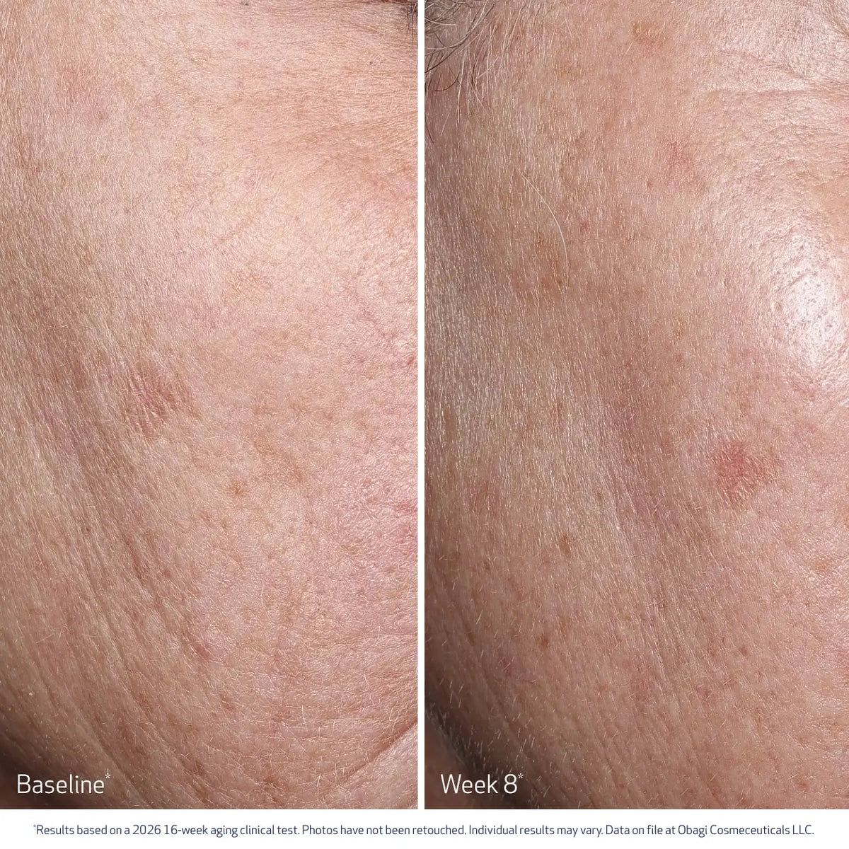 Obagi Professional-C Serum 20% image 5