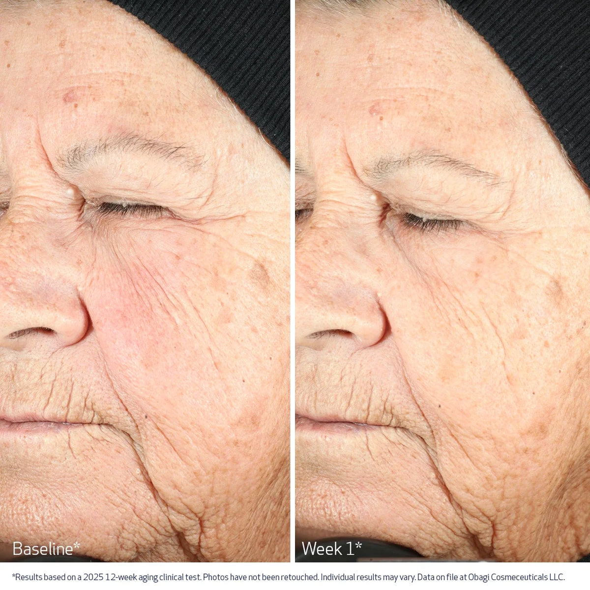 Obagi Nu-Gen Cellular Renewal Serum image 7
