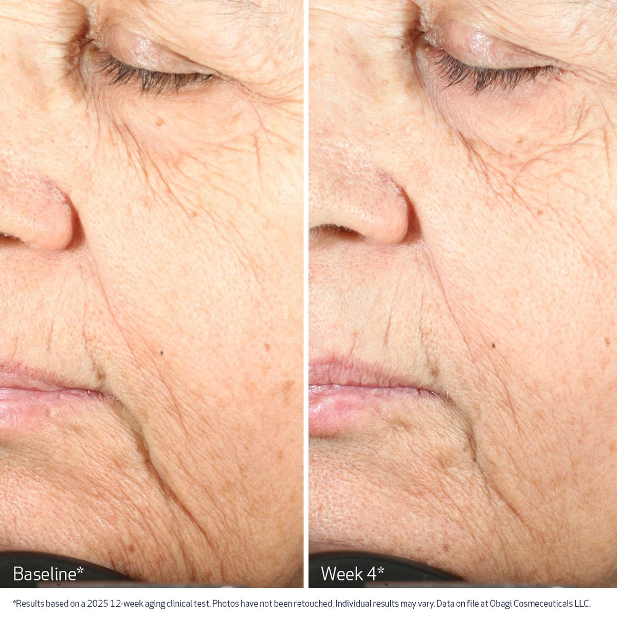 Obagi Nu-Gen Cellular Renewal Serum image 8
