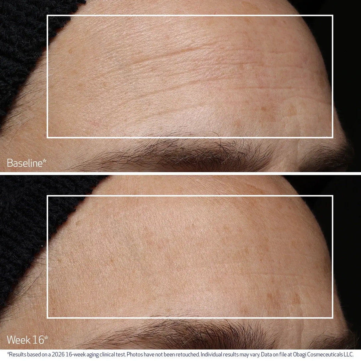 Obagi Professional-C Serum 20% image 4
