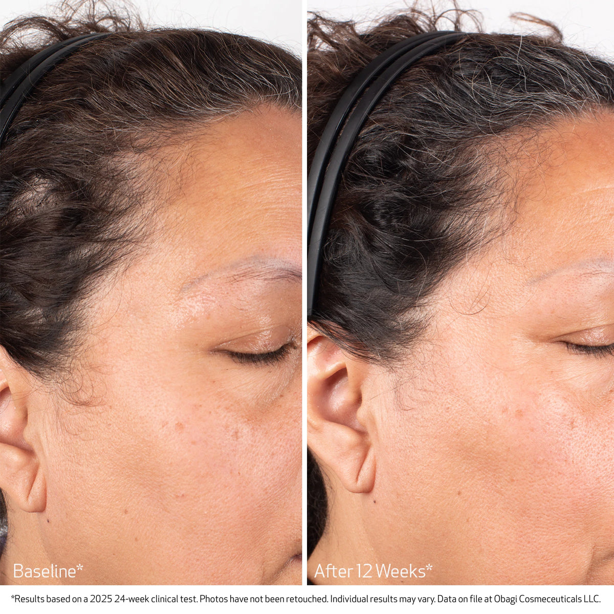 Obagi Nu-Cil BioStim Scalp Serum image 5