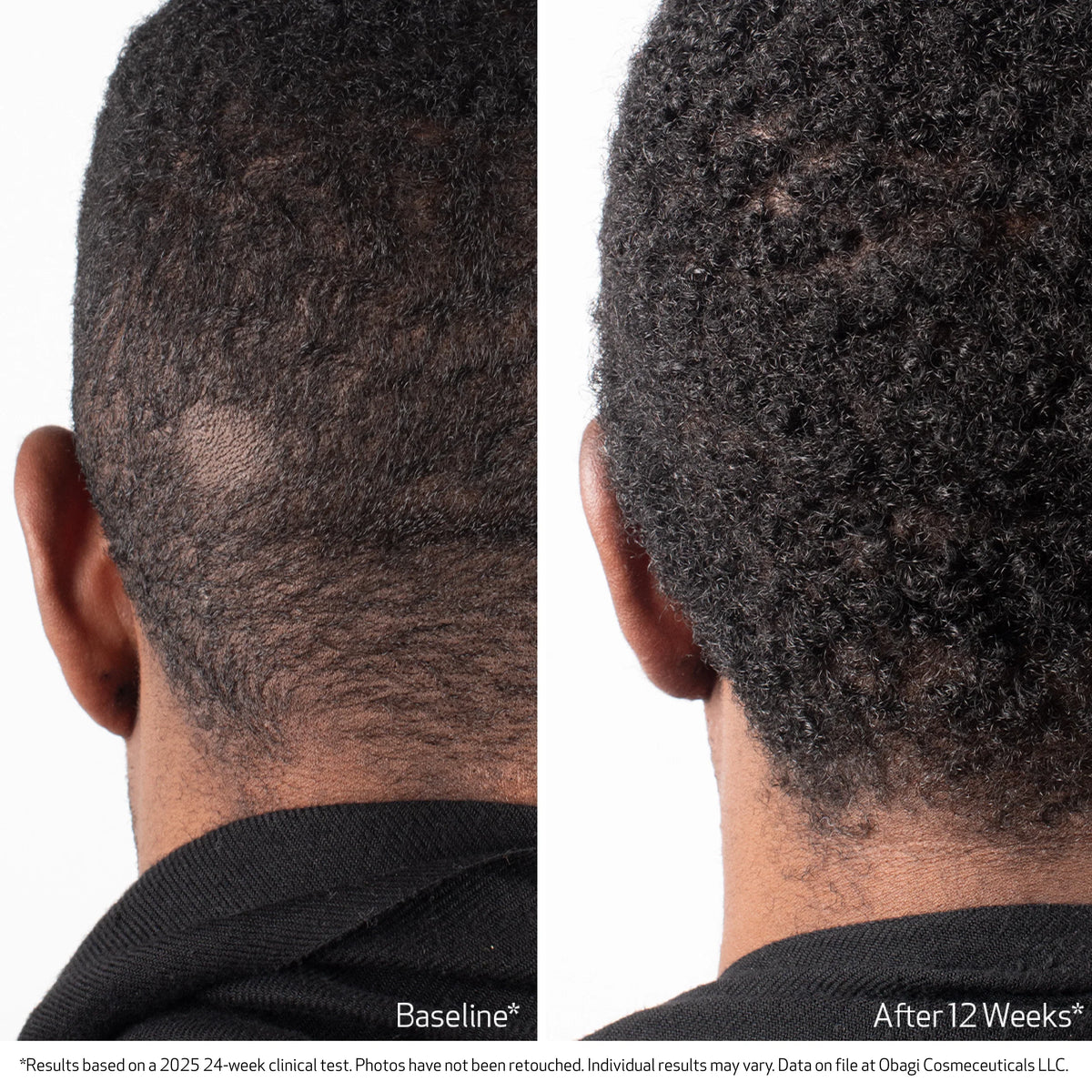 Obagi Nu-Cil BioStim Scalp Serum image 6