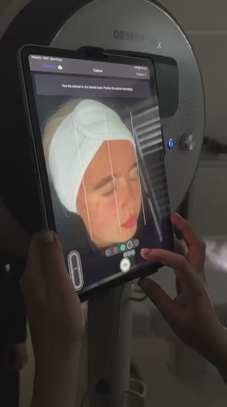 Observ 520x skin analysis scan